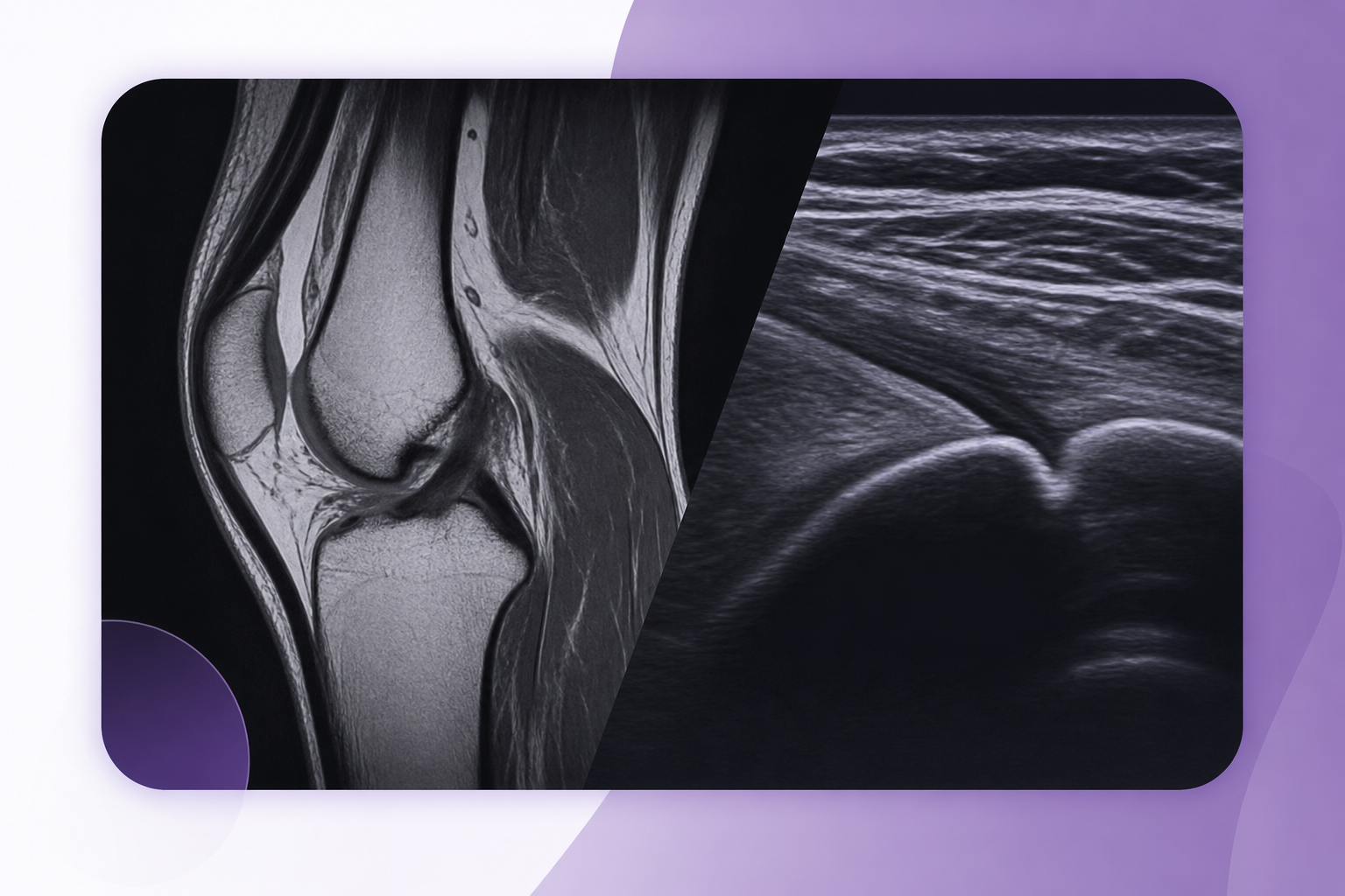 MSK Radiology